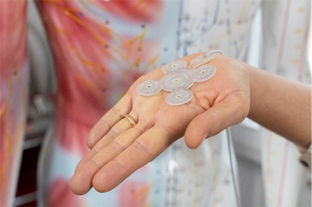 A New Option for Epilepsy Treatment: UK’s First EASEE® Implant